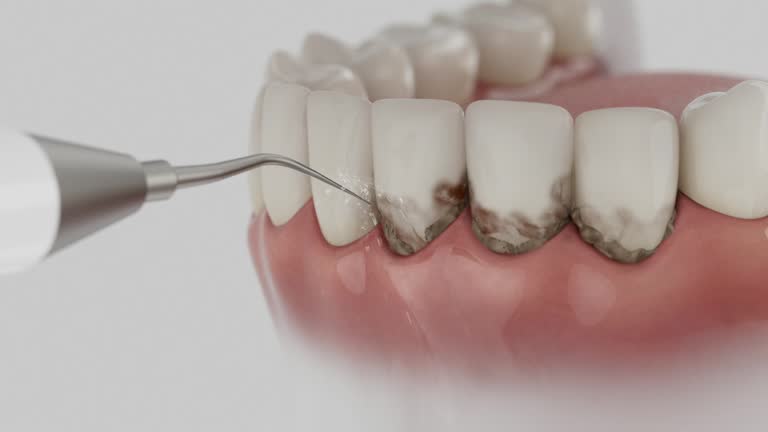 Trusted Teeth Cleaning And Checkup service in Kimberly, WI - Dentist Open Now